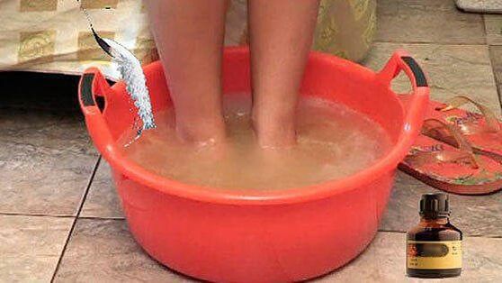 Fare un bagno caldo con iodio è una delle fasi del trattamento dei funghi alle unghie dei piedi