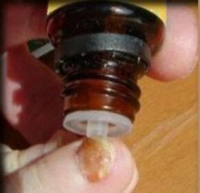 Applicazione di gocce su un'unghia colpita da funghi