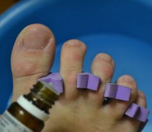 Preparazione al trattamento delle unghie con gocce antifungine